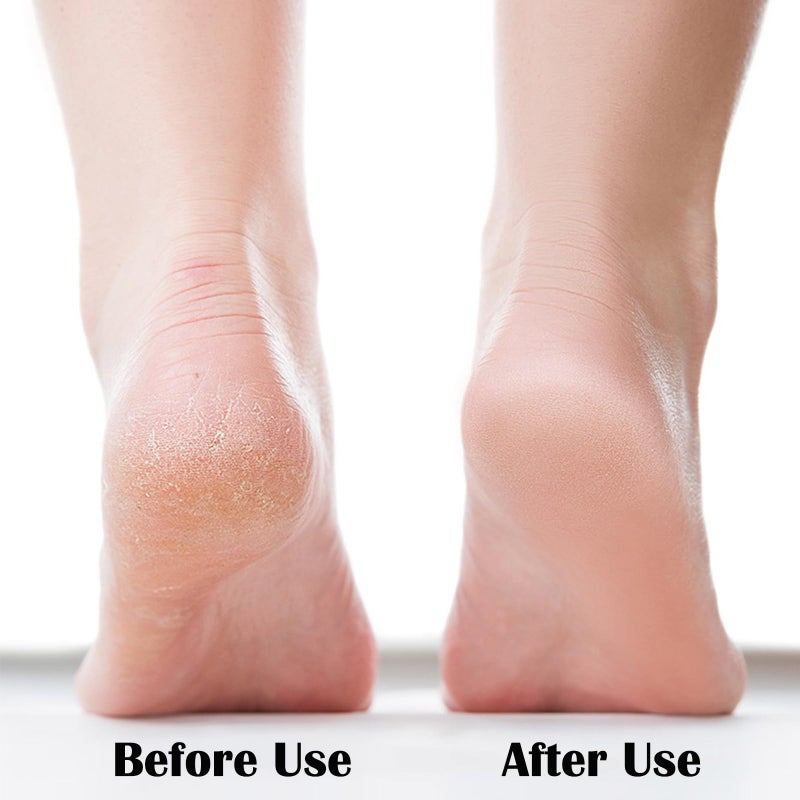 MR LION Nano Foot File  Foot Scrubber Callus Remover  Foot Care Pedicure Tool  Foot File with Nano-Level Grinding Points  Portable Foot Scrubber for Dead Skin Removal  Cracking  Wet and Dry Feet - Image 3